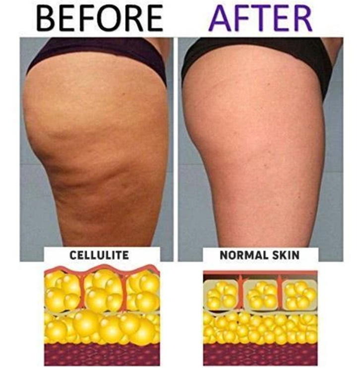 2026 Anti-Cellulite Compression High Waist Slim Leggings
